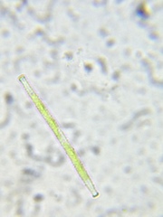 Gonatozygon brebissonii