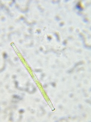 Gonatozygon brebissonii