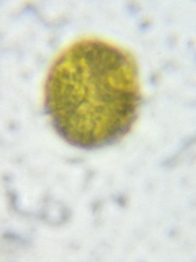 Parvodinium inconspicuum