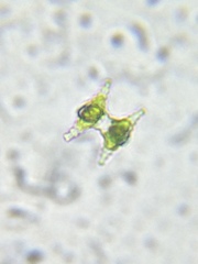 Staurastrum anatinum