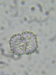 Cosmarium punctulatum