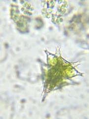 Staurastrum furcigerum