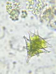 Staurastrum furcigerum