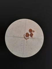 Fossombronia wondraczekii