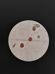 Fossombronia wondraczekii