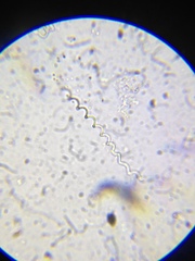 Spirochaeta
