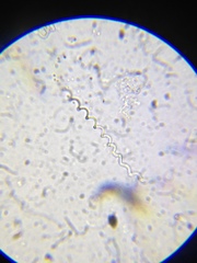 Spirochaeta
