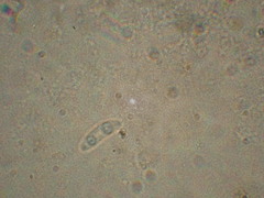 Chlorencoelia versiformis