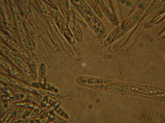 Chlorencoelia versiformis