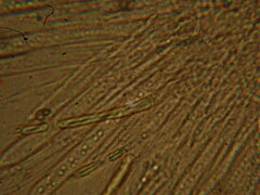 Chlorencoelia versiformis