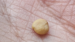 Toxicodendron vernicifluum