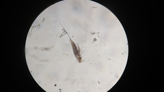Microsetella norvegica