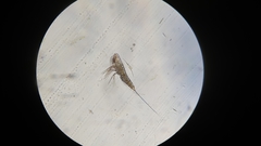 Microsetella norvegica