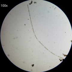 Charophyta