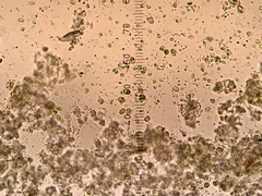 Chaenotheca trichialis