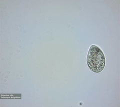 Tetrahymena