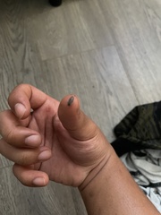 Porcellionides pruinosus