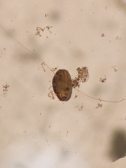 Ostracoda