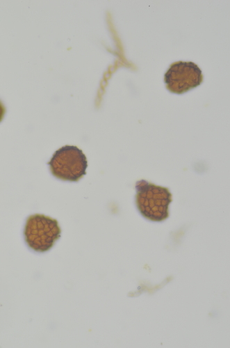 Image of Fossombronia foveolata by no rights reserved