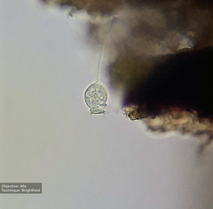 Vorticellidae