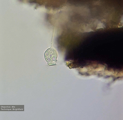 Vorticellidae