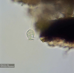 Vorticellidae