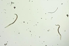 Nematoda