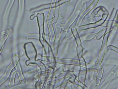 Radulomyces confluens