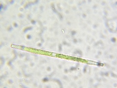 Gonatozygon brebissonii