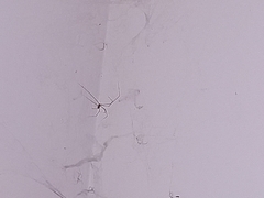 Physocyclus globosus