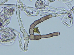 Alternaria