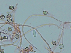 Hypomyces tremellicola