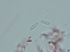 Hypomyces tremellicola