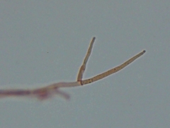 Hypomyces tremellicola