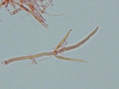 Hypomyces tremellicola