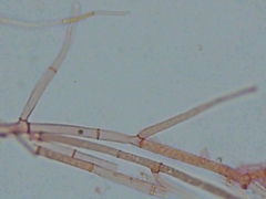 Hypomyces tremellicola