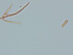 Hypomyces tremellicola