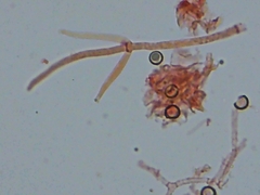 Hypomyces tremellicola