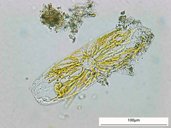 Tropidoneis