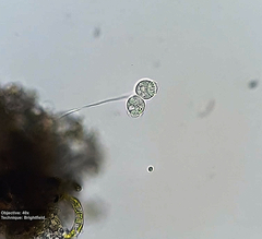 Vorticellidae