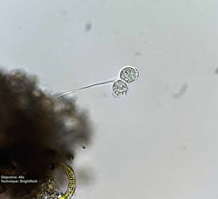 Vorticellidae