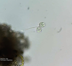Vorticellidae