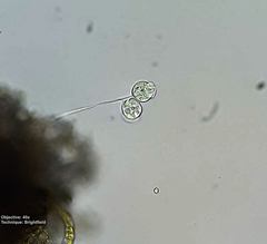 Vorticellidae
