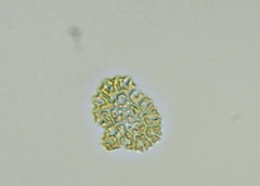 Hydrodictyaceae