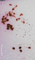 Nephrolepis cordifolia