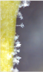 Paraperonospora leptosperma