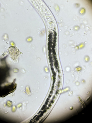 Nematoda