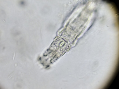 Rotifera