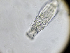 Rotifera