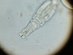 Rotifera